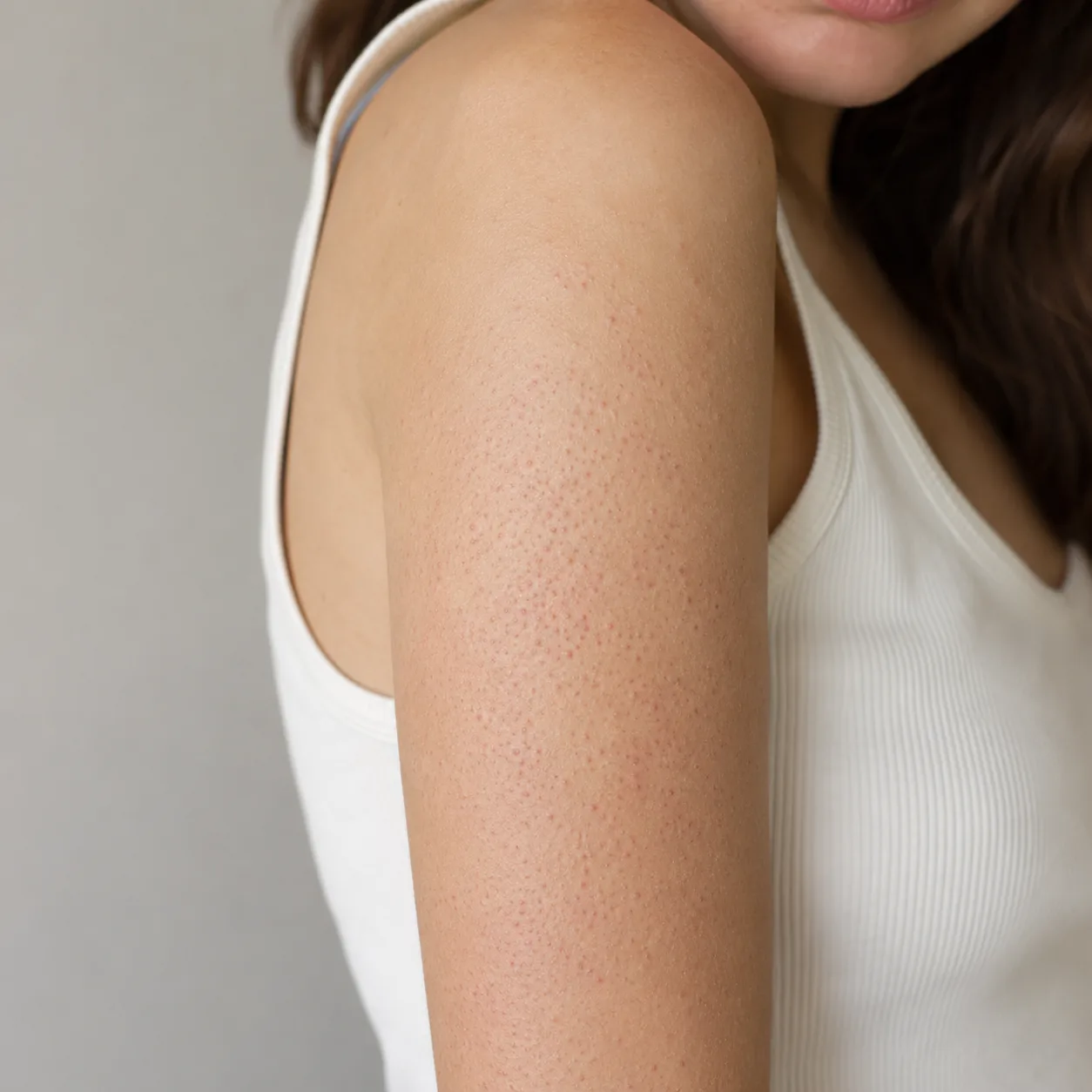 Rough Bumps on Arms